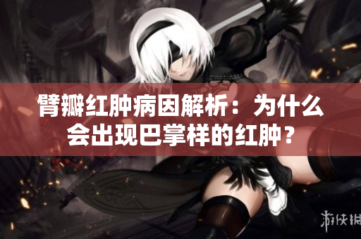 臂瓣紅腫病因解析：為什么會出現(xiàn)巴掌樣的紅腫？